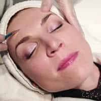 Dermaplaning Side Effects