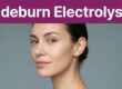 Sideburn Electrolysis for Women: What I Tell Clients