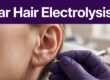 Gloved practitioner treating hair near an outer ear in a clean clinic.