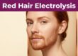 Three-quarter portrait of a fair-skinned woman with copper-red facial hair beneath a purple headline band.