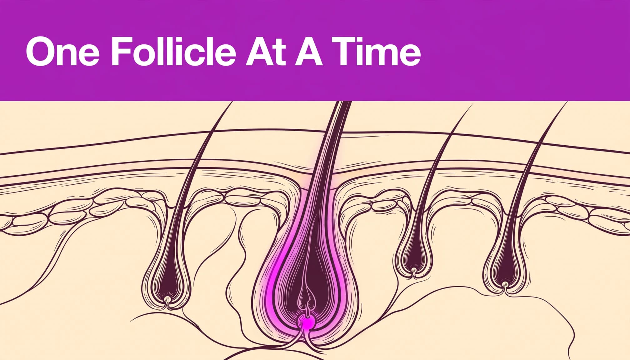 One highlighted hair follicle appears beneath smooth skin, with neighboring follicles nearby.